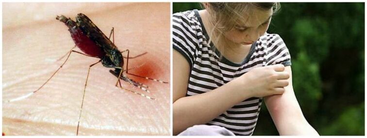 Болезнените бучки след ухапване от комар могат да бъдат симптом на дирофилариоза