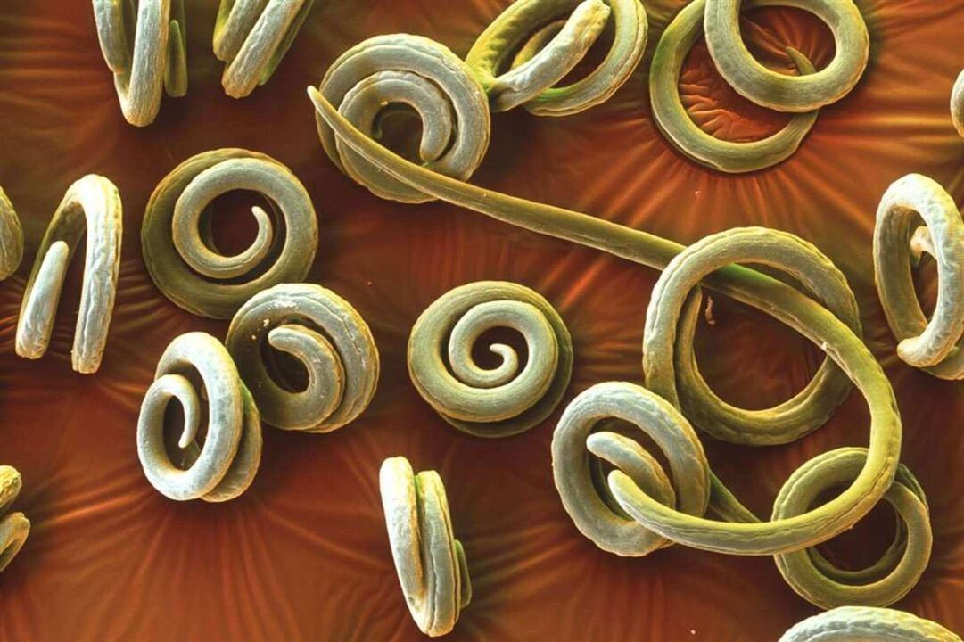 червеи паразити от човешкото тяло