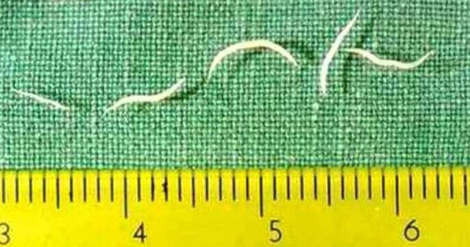 Pinworms са най-често срещаният вид червеи при малки деца. 