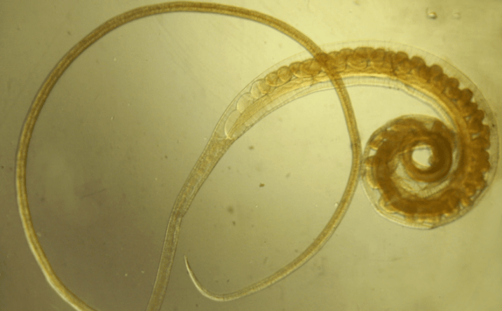 Човешки камшичен червей - хелминт, който засяга подрастващите