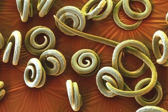 червеи в човешкото тяло