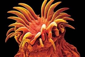 Трематодни паразити при хората