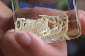 паразити от човешкото тяло