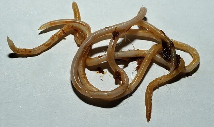 токсокара от човешкото тяло